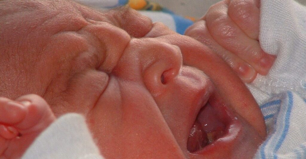 "Colichette" e spleen* neonatale – coliche del neonato