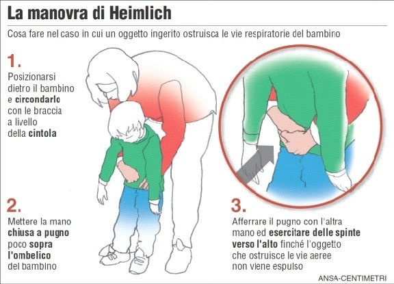 Manovra di Heimlich, disostruzione pediatrica, strozzamento, soffocamento